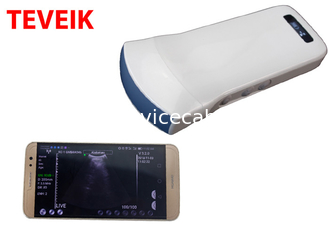 CE ISO13485 Handheld Wireless Ultrasound Probe Convex Wifi Ultrasound Instrument