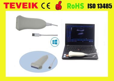 Lightweight usb ultrasound transducer for laptop computer, portable usb linear probe good price