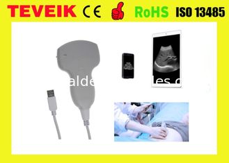 Cheaper USB Convex Probe Mini Ultrasound Device USB ultrasound scanner For Laptop/ Mobile