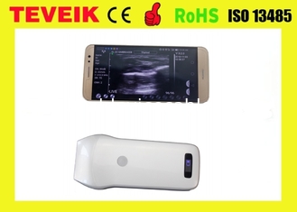 Wireless wifi ultrasound probe with color doppler, wifi ultrasound Machine , wifi electric linear ultrasound transducer