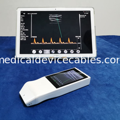 Wireless Ultrasound Tranducer Android Color Doppler Ultrasound Probe Wireless Charging