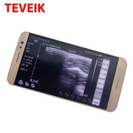 USB Ultrasound Transducer Probe Convex for IOS, Android and Windows