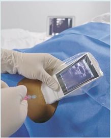 Medical Wifi Ultrasound Machine Android Portable Wireless Ultrasound Probe Linear