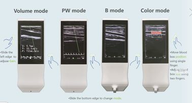 Medical Wifi Ultrasound Machine Android Portable Wireless Ultrasound Probe Linear