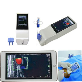 Wireless Ultrasound Tranducer Android Color Doppler Ultrasound Probe Wireless Charging