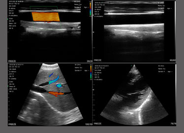 Double Heads Wireless Ultrasound Probe 3 In 1 Cardiac Convex Linear Color Doppler