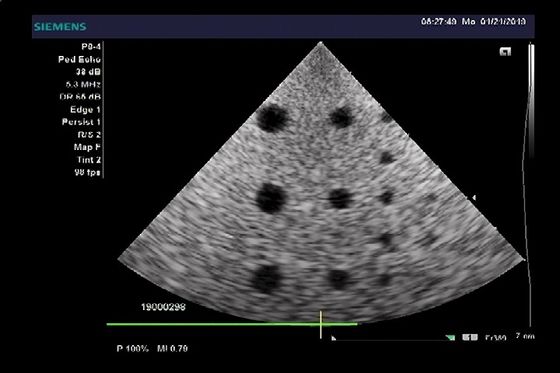 Pediatric Siemens Medical Ultrasound Transducer P8-4 Cardiac For P8-4