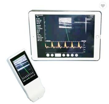 Medical Wifi Ultrasound Machine Android Portable Wireless Ultrasound Probe Linear