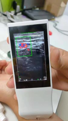 Medical Wifi Ultrasound Machine Android Portable Wireless Ultrasound Probe Linear