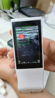 Medical Wifi Ultrasound Machine Android Portable Wireless Ultrasound Probe Linear